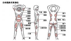 自体脂肪填充有哪些优点和缺点