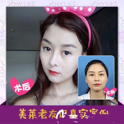 深圳美莱医疗整形美容医院