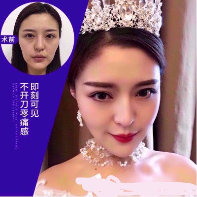 深圳美莱医疗整形美容医院多方面部