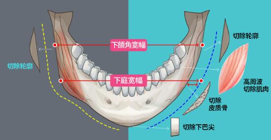 八大处下颌角图片