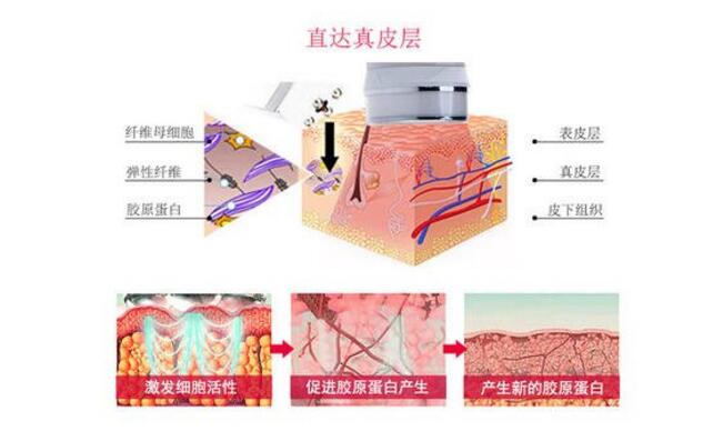 彩光嫩肤要多少钱