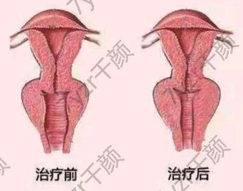 为什么现在女性越来越重视私密保养与整形了？